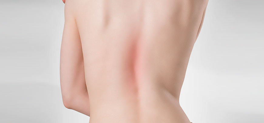 patient needing scoliosis treatment in Hayward
