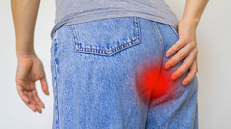 patient requiring tailbone pain treatment in Hayward CA
