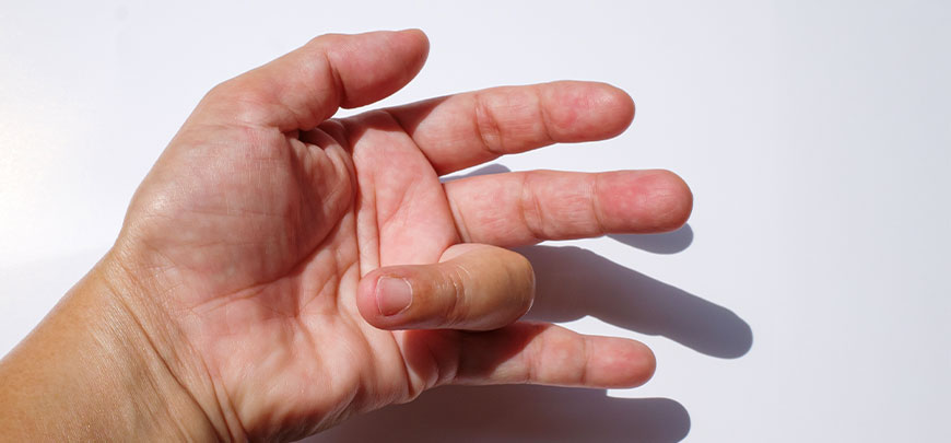 patient needing trigger finger treatment in Hayward