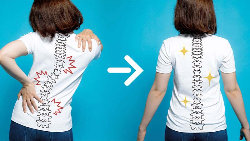 comparing bad posture to good posture